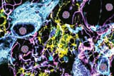 Biboobraintissue