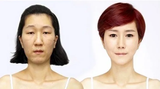 seonghyeong-munhwa-korean-beauty-standards-before-after