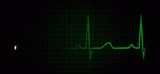 cardiogram
