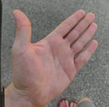 1000012645