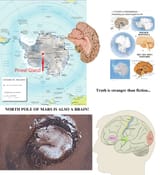 Brain Planets