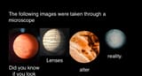 MicroscopePlanets