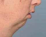 yourchin