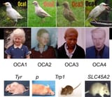 albinism-isnt-always-white-with-red-eyes-pics-from-studying-v0-2r2zcfgxvv4d1