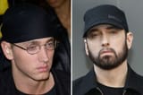 Eminem-beard-transplant