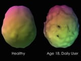 SPECT_imaging_cannabis