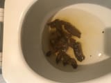 Fecal_poop_2