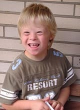 Boy_with_Down_Syndrome