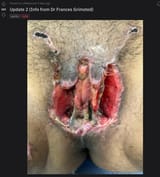 jannie new vagina