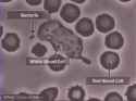 white blood cell consuming bacteria_thumb.jpg