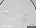 cells burst under osmotic pressure _thumb.jpg
