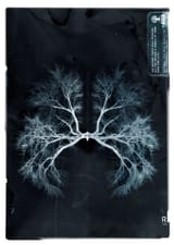 Porcupine Tree