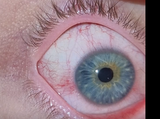 eye