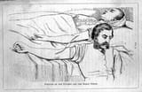 patient-blood-donor-transfusion-19th-century