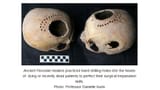 Practice-skull-surgery-in-ancient-Peru