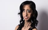 Lizzie_Velasquez_3232814b