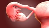 ovary-size