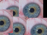eye