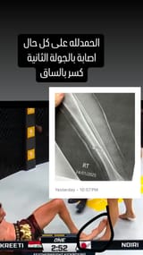 iraqichickenlegs